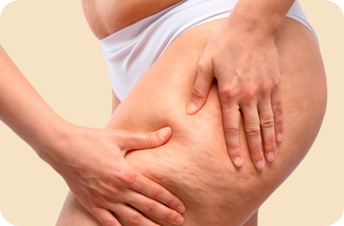 Imagem sessão lipedema